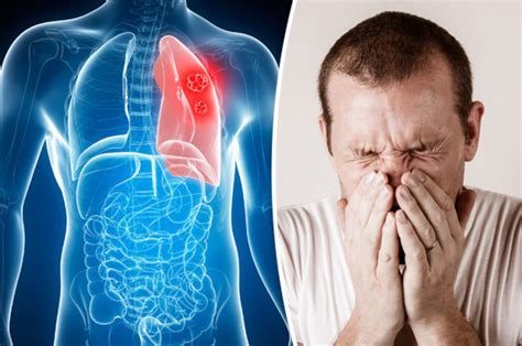 Lung Cancer Symptoms And Prevention Seven Signs Of A Tumour You Should