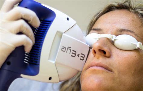 zabieg ipl  leczeniu zespolu suchego oka okulista krakow