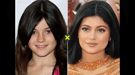 Kylie Jenner Antes E Depois Then And Now Youtube