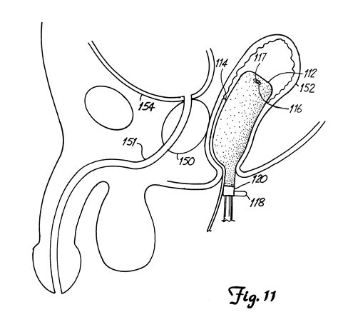 patent us6348039 rectal temperature sensing probe
