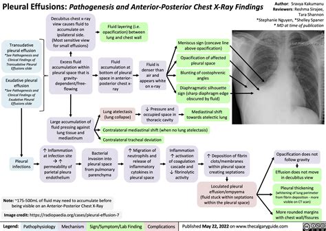 pleural effusions pathogenesis  anterior posterior chest  ray findings calgary guide