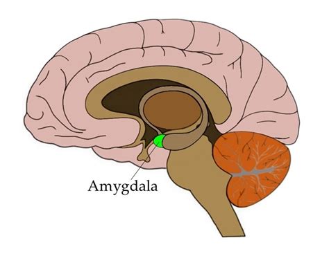 abnormal amygdala connections  chronic pain  pain pt