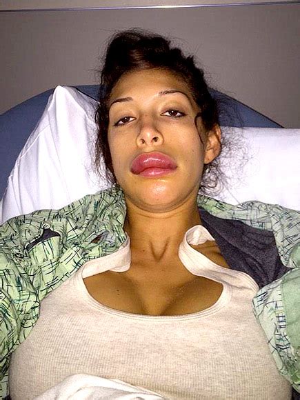 teen mom s farrah abraham reveals botched lip implants photo