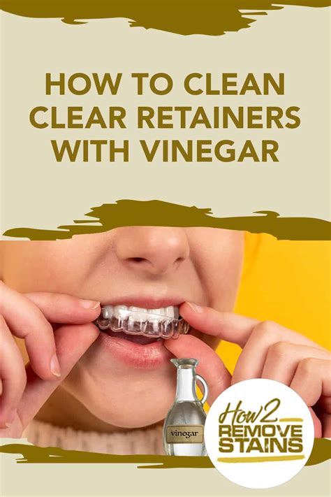 clean clear retainers  vinegar detailed answer