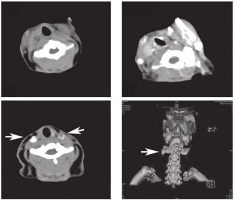 Imaging Findings Of Cervical Lymph Nodes A On Plain Ct Images