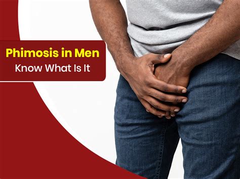Phimosis In Men Know Symptoms Causes And Treatment Options Phimosis