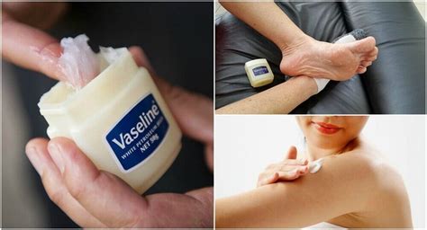 6 Medicinal Uses For Vaseline That Youll Want To Know Step To Health