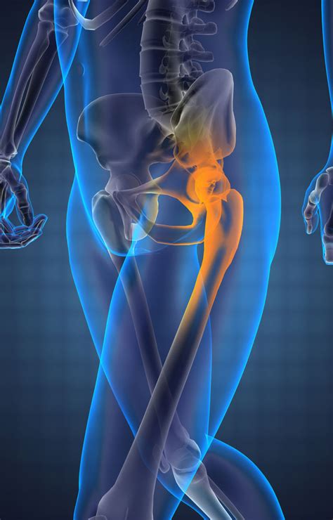 treat hip pain central orthopedic group