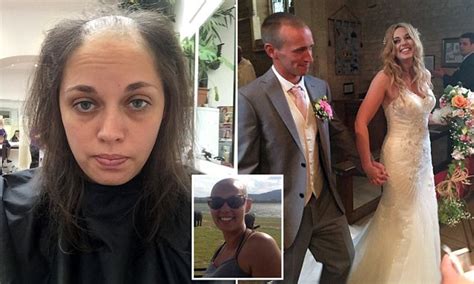 saltby bride who was bald from hair pulling addiction weds