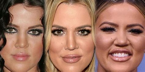 khloé kardashian face filler transformation buzzpopdaily