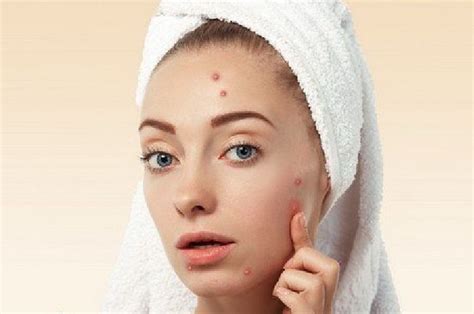 Wajib Tahu 4 Bahan Skincare Ini Hanya Bikin Jerawat Makin