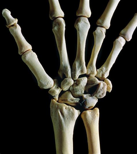 bones   wrist joint photograph  james stevensonscience photo