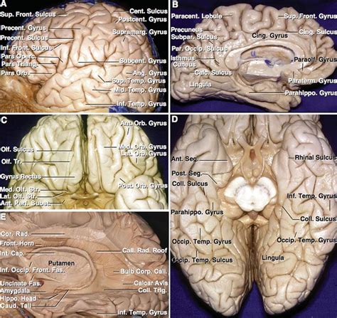 identification  sulci  gyri neuroanatomy  neurosurgical atlas