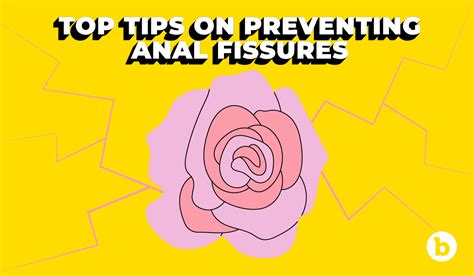 anal fissures a doctor s guide to prevent them before having anal sex