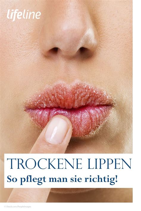 Trockene Lippen • Ursachen Pflege And Hausmittel Trockene Lippen