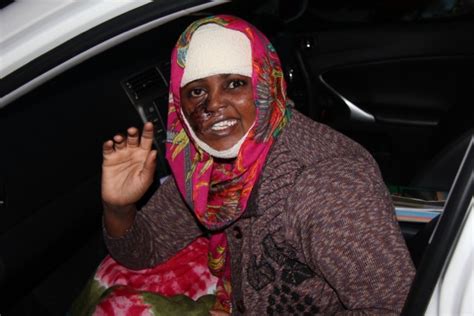 a new face for somali woman shot 25 years ago thanks to 3d printing the voice