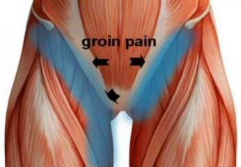 diagram  male groin area defining  groin measurement area