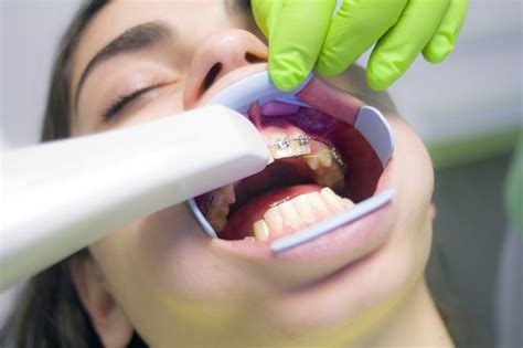 nieuwe zorgverzekering afsluiten kinderen zijn standaard verzekerd voor de tandarts ikenmamanl