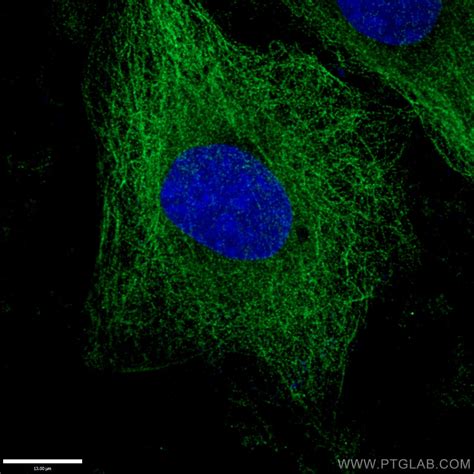 alpha tubulin antibody   ap