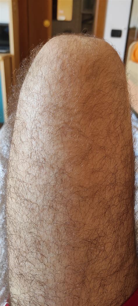 Are My Legs Too Hairy Lol R Malegrooming