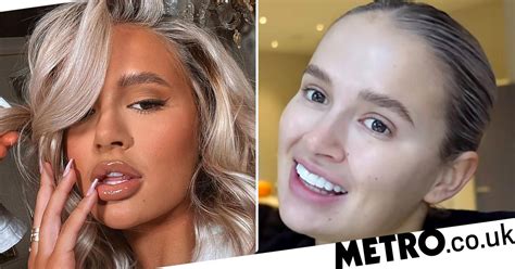 molly mae hague s lips have ‘stretched after having fillers dissolved