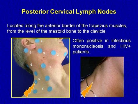 lymph nodes examination examination   lymphatic system