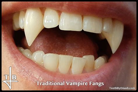 traditional vampire teeth  dnash
