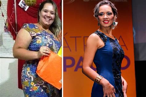 slimmer becomes first woman to win gastric bypass beauty pageant look