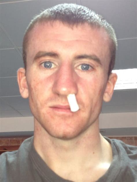 irish boxer paddy barnes   euro final  broken nose donegal