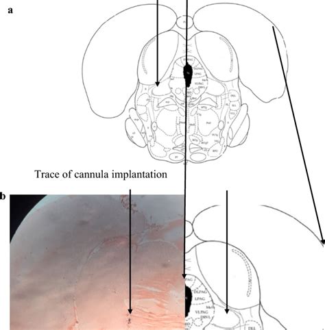 schematic drawing   rat brain coronal section  paxinos   scientific diagram