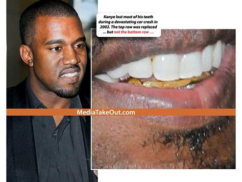 car accident kanye west  car accident