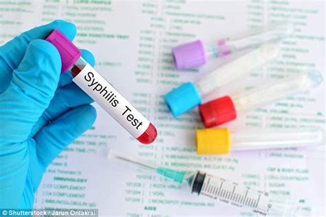 Syphilis Sufferer Calls For A Debate Into The Sti As Cases Rocket To