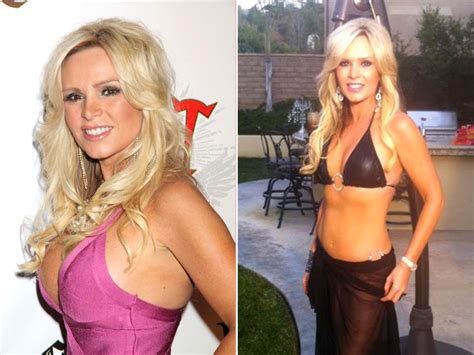 10 Celebrities Who Had Their Breast Implants Removed