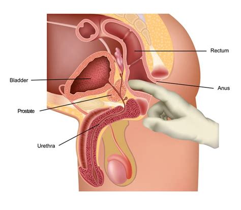 prostate orgasm with sounds mega porn pics
