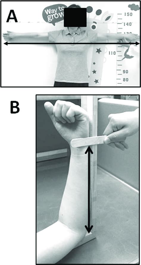 illustrations  measurements   arm span length   ulnar