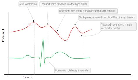 interpretation   central venous pressure waveform deranged physiology