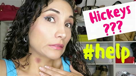 how to hide a hickey how to get rid of a hickey 2018 kali sanchez