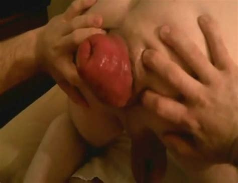 Rectal Prolapse Licking With Amateur Buddies Gay Bizarre Gay Fetish