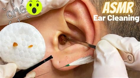 asmr worlds s greatest ear cleaning on real person ear wax removal