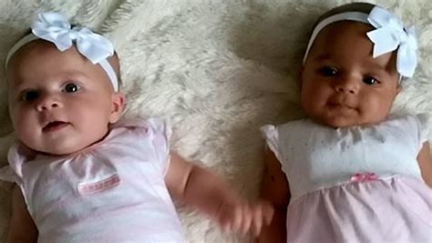 Black Twin White Twin Mum Gives Birth To Twins With Different Skin