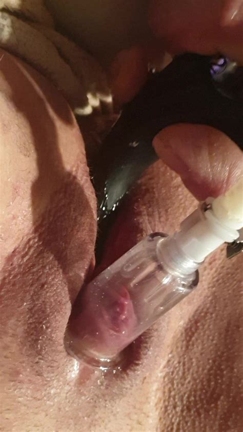 Clitoris Vacuum Suck Free Xshare Mobile Hd Porn Video B0 Xhamster