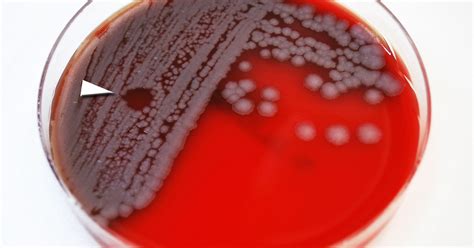 shipment  suspected  anthrax closes delaware lab