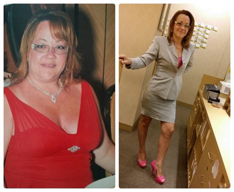 May Member Spotlight Weight Loss Surgery Before And After