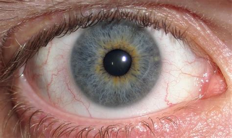 typical polish eye color