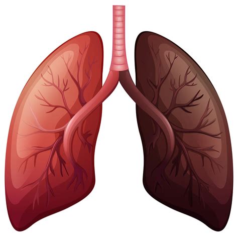 lung cancer diagram  large scale  vector art  vecteezy