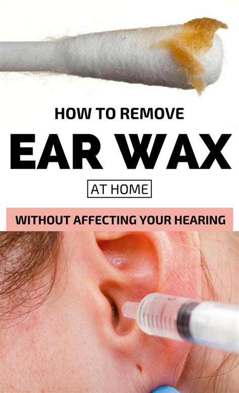 remove ear wax    ear howtoremvo