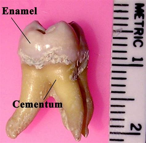 tooth enamel alchetron   social encyclopedia