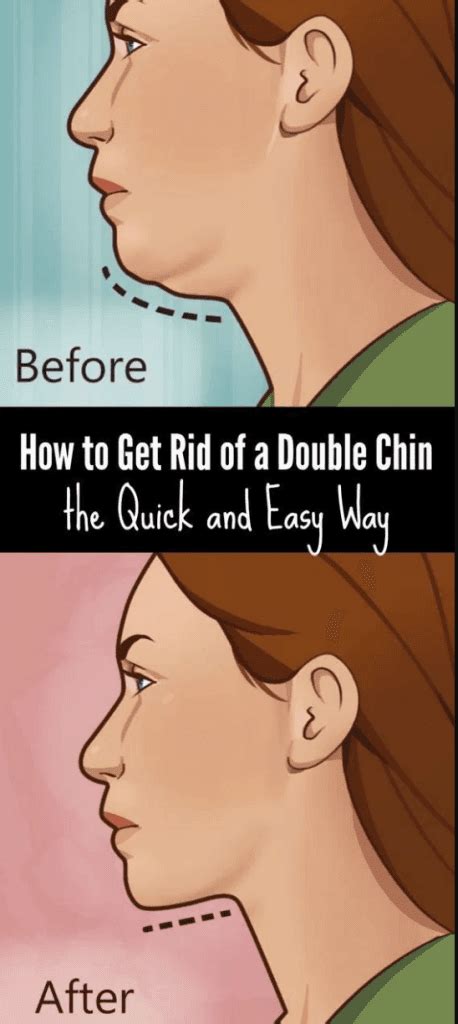 Get Rid Of Double Chin The Fast And Easy Way Fitness