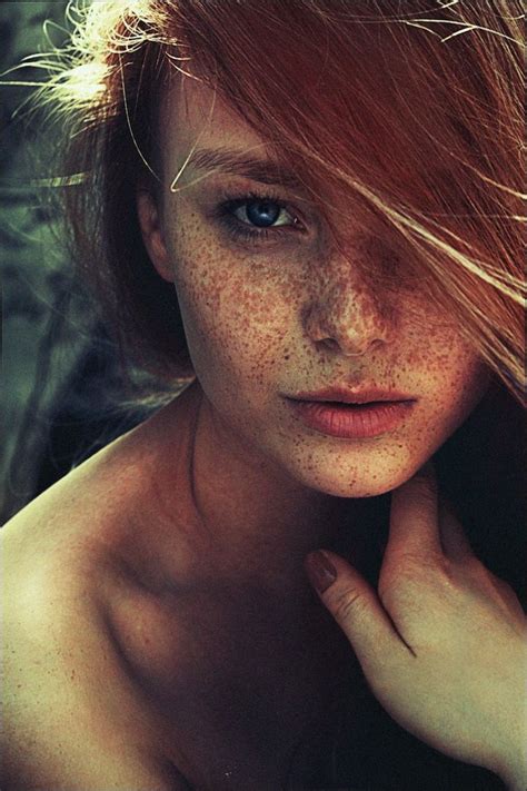 is society still picking on girls with freckles because i think freckled girls are beautiful