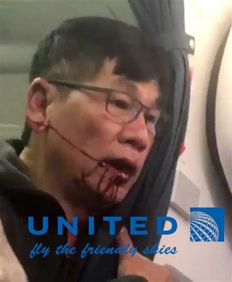 that doctor who got pulled off the united flight fell